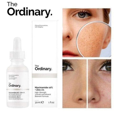 The Ordinary Niacinamide 10% + Zinc 1% Face Serum Canada Imported