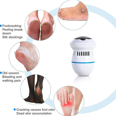 Electric Foot Pedicure